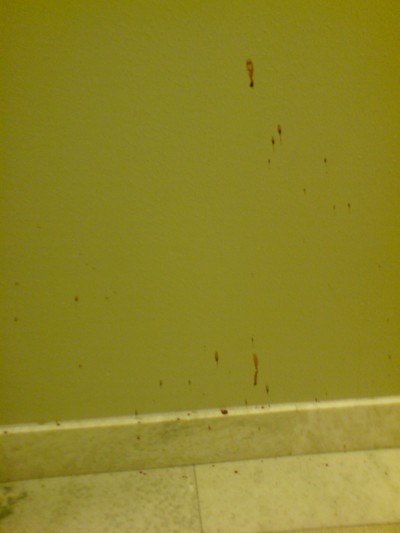 Jag tog även lite bilder på det överdrivna blodbadet i trappuppgången från inbrottet i förra veckan. 